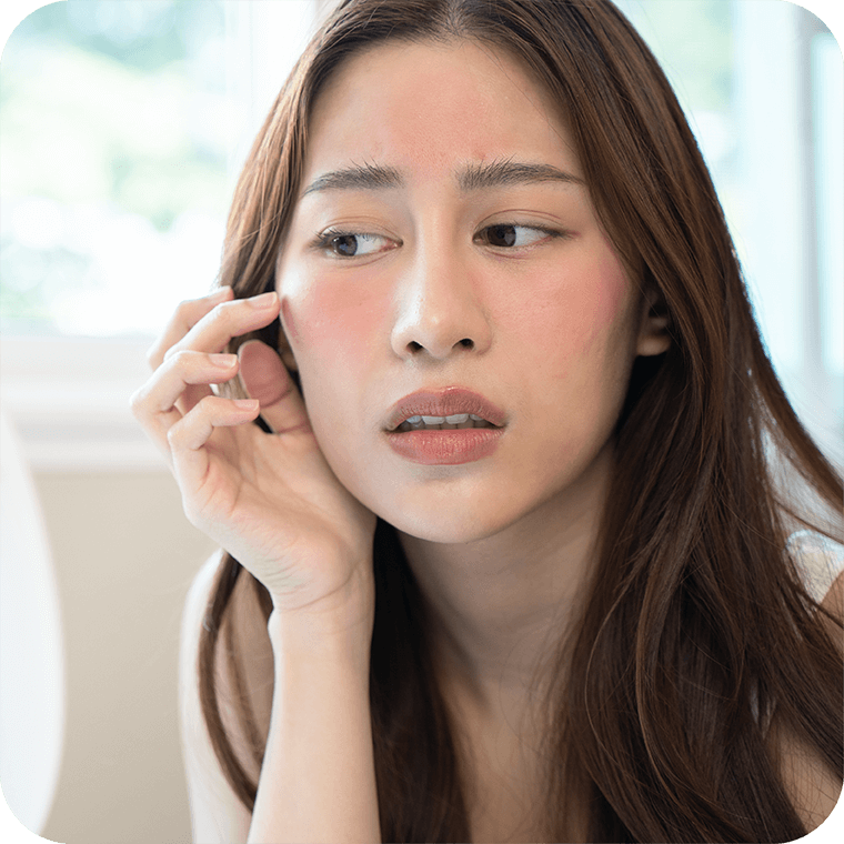 Women-Skin-allergy-rash-redness